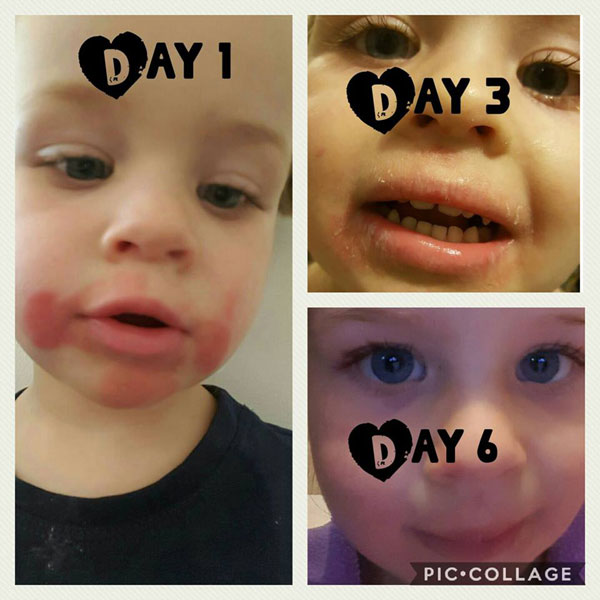 1443strictelimination