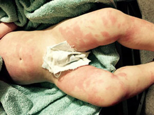 changeorgglutaminase