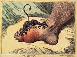 gout01